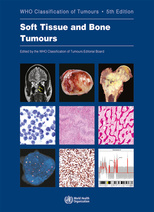 Soft Tissue and Bone Tumours: WHO Classification of Tumours ,5e