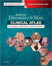 Andrews Diseases of the Skin Clinical Atlas, 1e